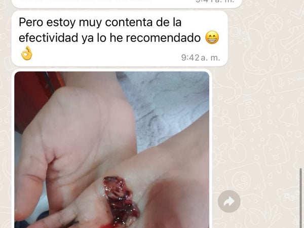 Vivía inflamada, con el abdomen duro, y sangraba un montón.”