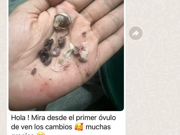 “Me daba vergüenza tener relaciones.”